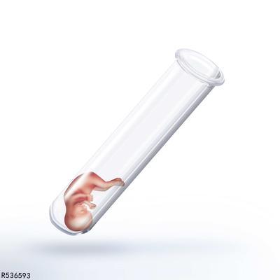助孕试管能知道的信息很少